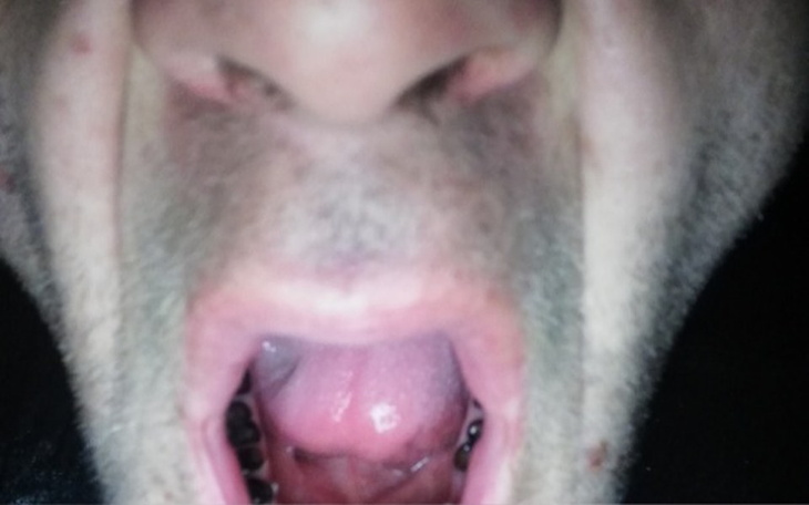 Zbiórka Zbieram na leczenie zębów - zdjęcie główne