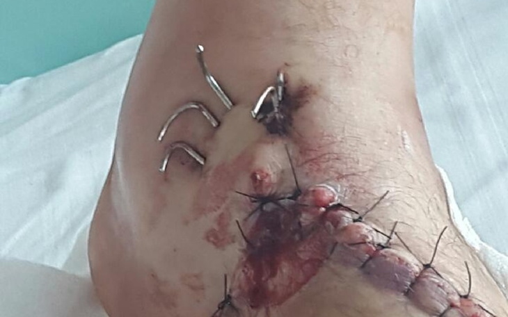 Zbiórka Pbiurka finasowa - zdjęcie główne