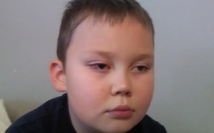 Zbiórka Operacja oka dla KRZYSIA - zdjęcie główne