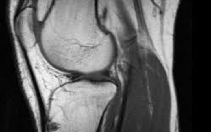 Zbiórka Operacja zerwanych więzadeł - zdjęcie główne