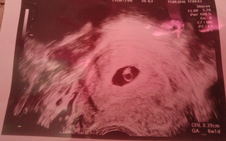 Zbiórka Moj wlasny kąt - zdjęcie główne