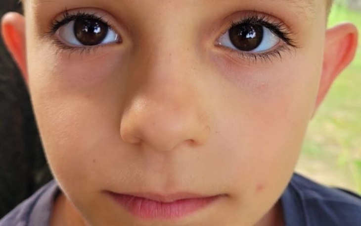 Zbiórka Operacja Nóżki Stefanka - zdjęcie główne