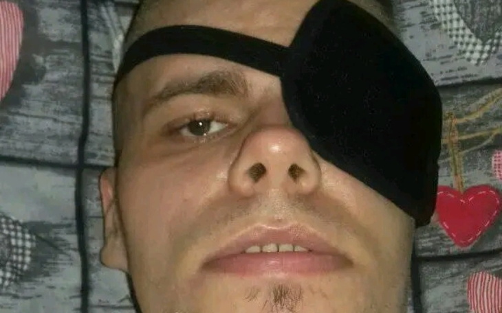 Mężczyzna z opaską na oku, uśmiechający się do kamery.