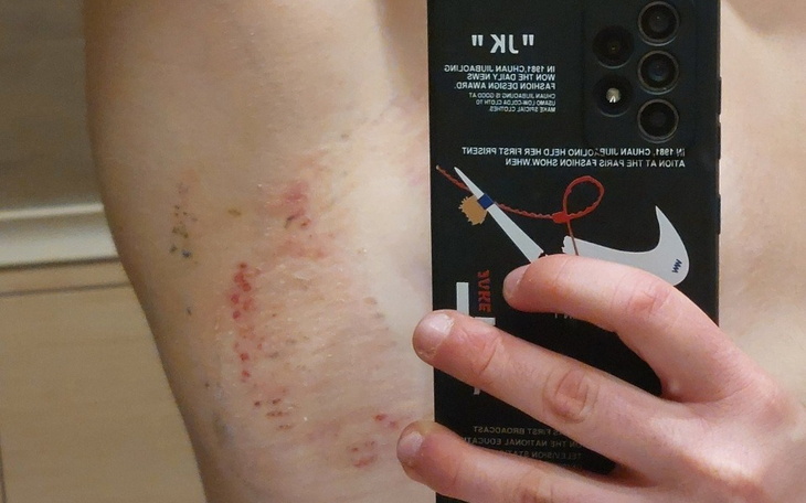 Zbiórka Na tranzycję - Sąd i Operacja - zdjęcie główne