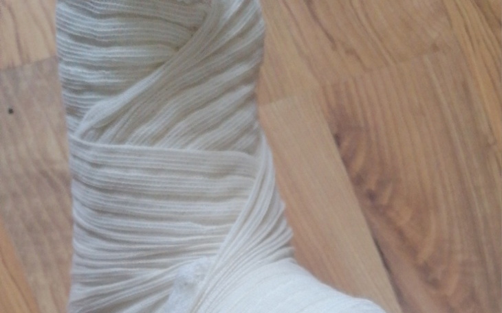 Zbiórka Na rehabilitację stopy - zdjęcie główne