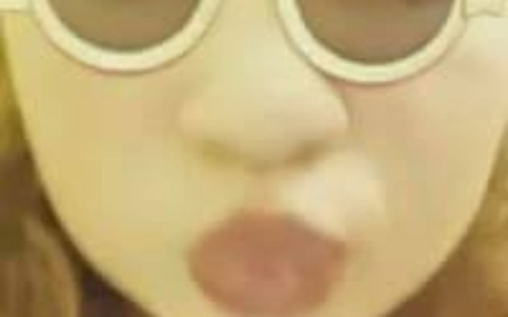 Zbiórka Nowa twarz dla Natalii D. - zdjęcie główne