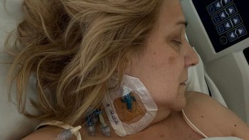 Zbiórka Pomóż w leczeniu Agnieszki - miniaturka zdjęcia