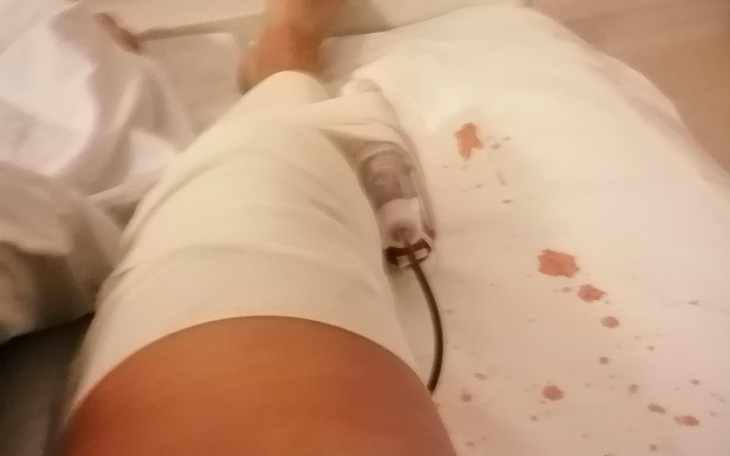 Zbiórka Na leczenie rehabil po zabieg - zdjęcie główne