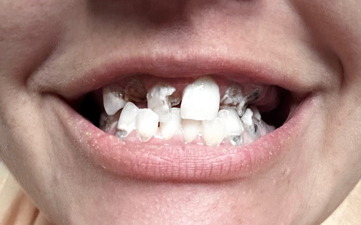 Zbiórka Nowy start, leczenie zębów - zdjęcie główne