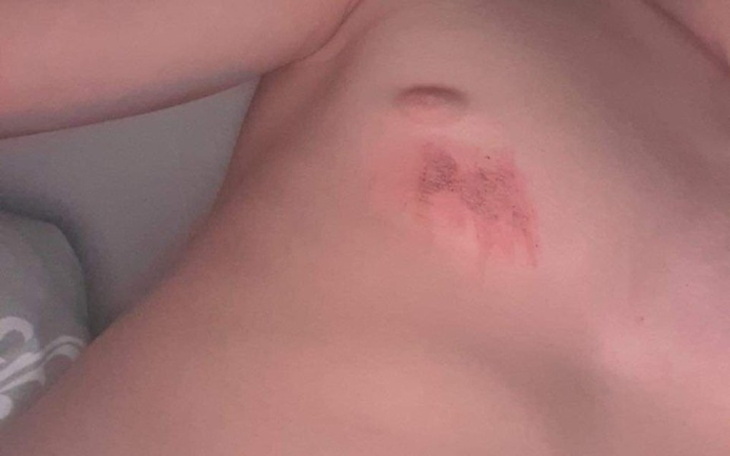 Zbiórka Pomoc koledze w leczeniu zaburzń - zdjęcie główne