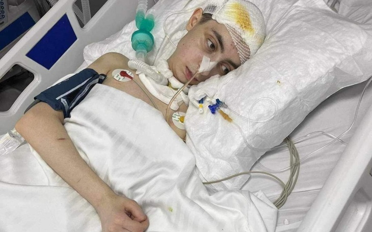 Młoda osoba leżąca w szpitalnym łóżku z opatrunkami na głowie.