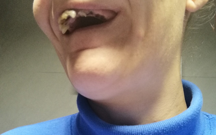 Zbiórka Na żeby przez lata wybijane prze - zdjęcie główne