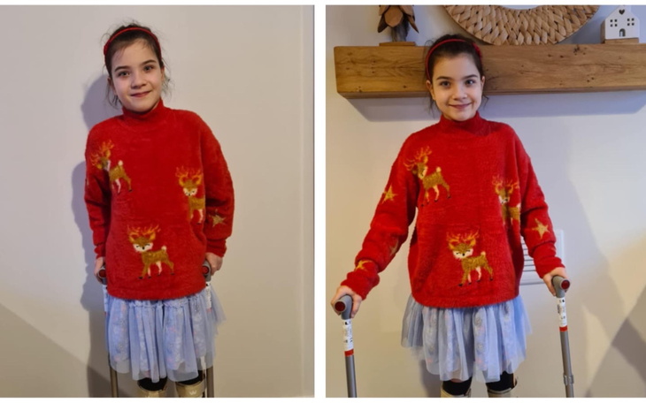 Dziewczynka w czerwonym swetrze z reniferami, trzymająca kule.