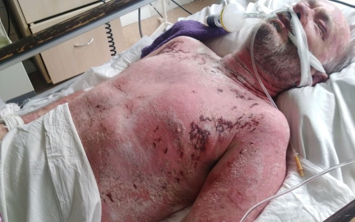 Zbiórka Leczenie mojego ojca - zdjęcie główne