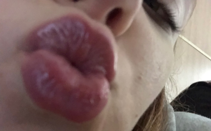 Zbiórka biedna jestem dajcie cos - zdjęcie główne