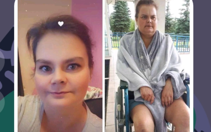 Zbiórka Pomoc w rehabilitacji i leczeniu - zdjęcie główne