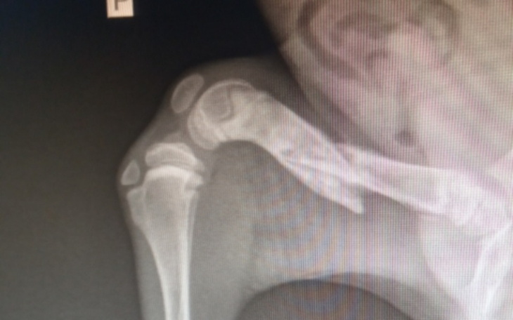 Zbiórka Oszukać przeznaczenie... - zdjęcie główne