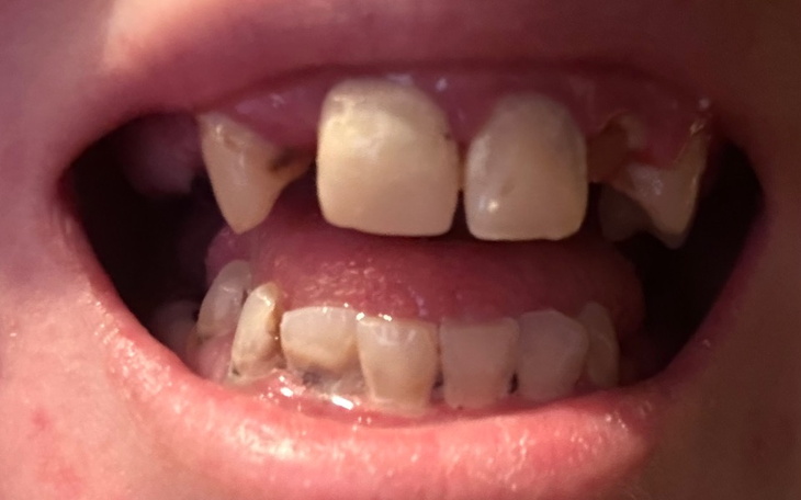 Zbiórka Nowy usmiech Mamy - zdjęcie główne