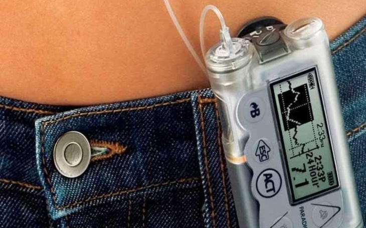 Urządzenie do monitorowania poziomu glukozy, przymocowane do spodni.