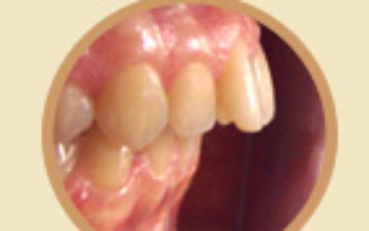 Zbiórka Zbiórka na zwalczenie kompleksu - zdjęcie główne