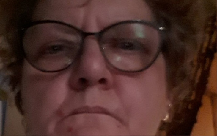 Zbliżenie na osobę w okularach, z poważnym wyrazem twarzy.