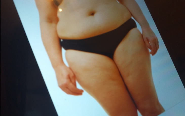 Zbiórka Niepelno sprawność brzuchy - zdjęcie główne