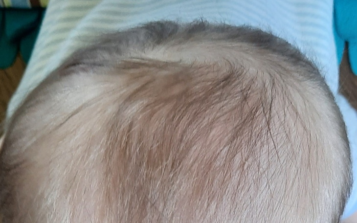 Zbiórka Korekcyjny kask - zdjęcie główne