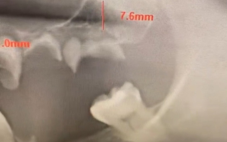 Zbiórka Operacja Przesunięcie Rzuchwy - zdjęcie główne