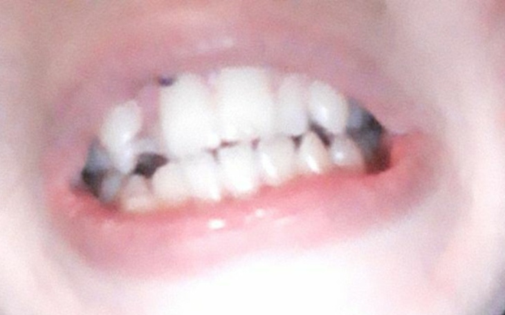 Zbiórka Aparat stały - zdjęcie główne