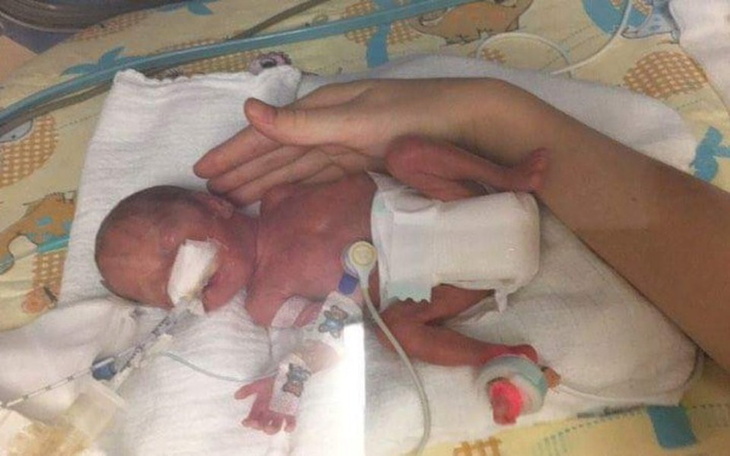 Noworodek w inkubatorze, trzymany przez rodzica.