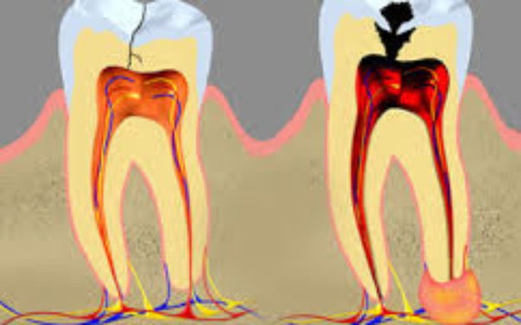 Zbiórka Naprawa zębów - zdjęcie główne