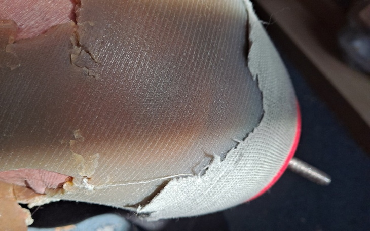 Zbiórka Zbieram na protezę podudzia - zdjęcie główne