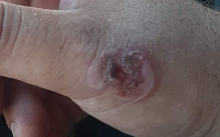 Zbiórka Wrócić do gry - zdjęcie główne