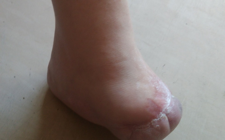 Zbiórka Stopa - zdjęcie główne