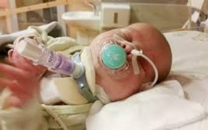 Zbiórka Potrzebna pomoc dla Moniki - zdjęcie główne