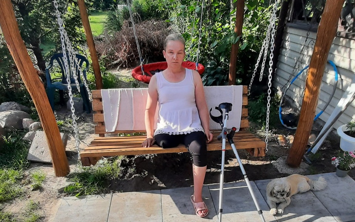 Zbiórka Zbieram na proteze nogi prawej - zdjęcie główne