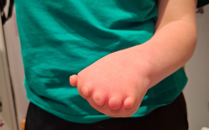 Dziecięca ręka z małym palcem u nogi.
