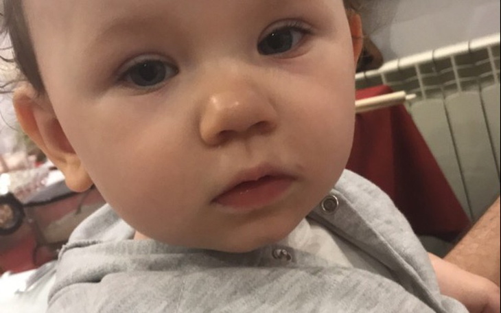 Zbiórka Na leczenie mojej siostry - zdjęcie główne