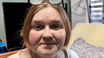 Zbiórka ❤️ Pomóżmy Małgosi walczyć o życie, zdrowie i nadzieję 🍀 - miniaturka zdjęcia