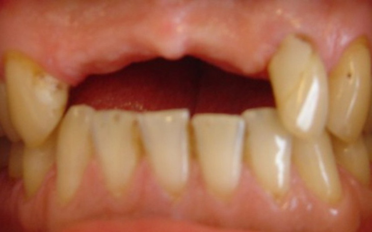 Zbiórka Nowe zęby dla Mamy <3 - zdjęcie główne