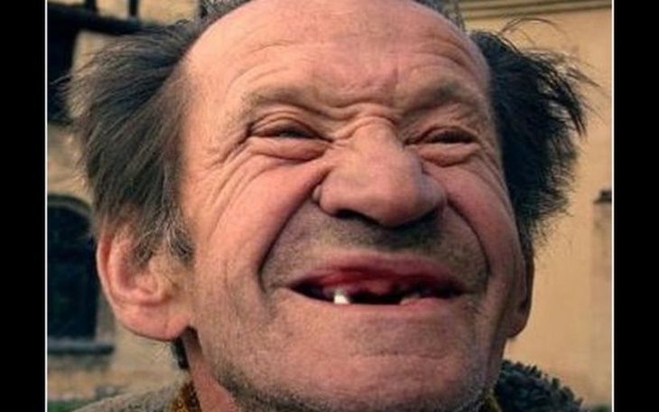 Zbiórka NA NOWE ZĄBKI DLA KOLEGi - zdjęcie główne