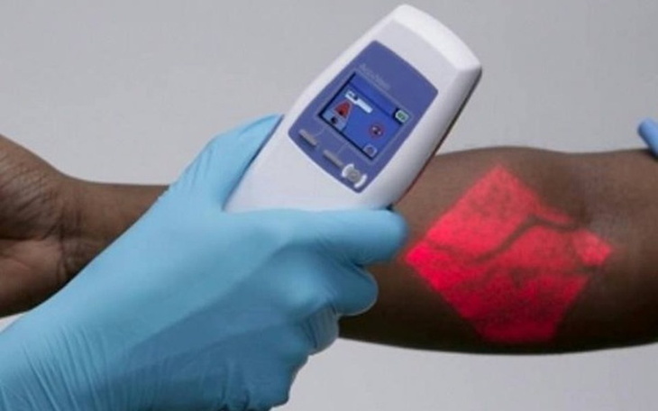 Zbiórka Zakup skanera żył na oddział. - zdjęcie główne