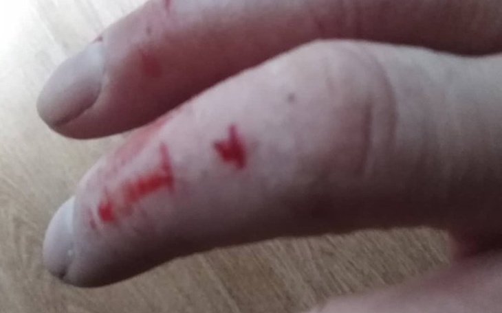 Zbiórka PILNA Pomoc w LECZENIU - zdjęcie główne