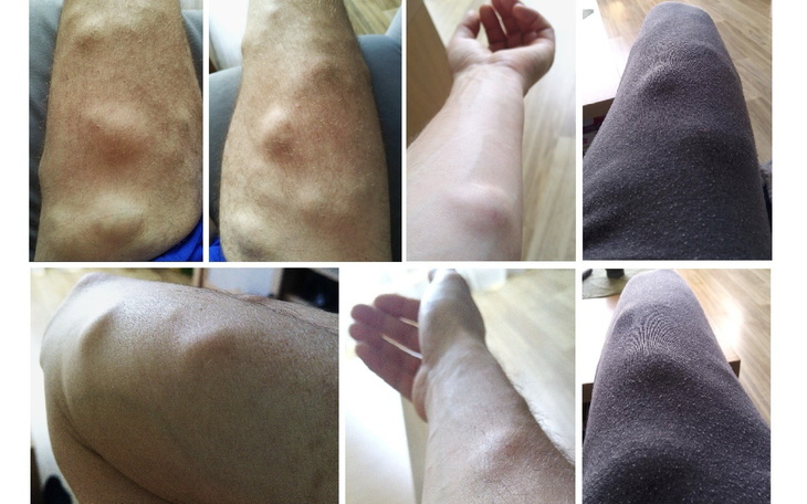 Zdjęcie nóg z widocznymi konturami i odciskami.