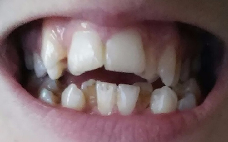 Zbiórka Zbieram na aparat ortodontyczny - zdjęcie główne