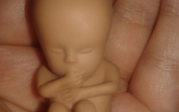 Zbiórka Fundacja Dwa Kilogramy Szczęścia - zdjęcie główne