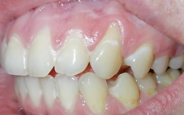 Zbiórka Pomóż mi w walce z Paradontozą - zdjęcie główne