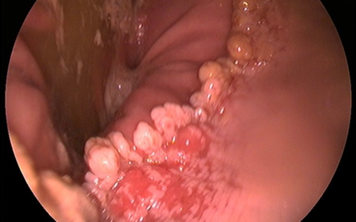 Zbiórka Wrzody u przyjaciela - zdjęcie główne