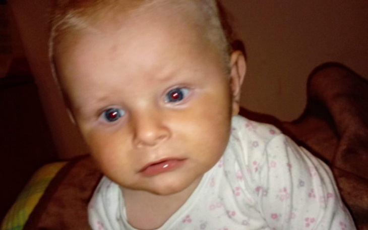 Zbiórka Ratujmy świat małego Ksawerego - zdjęcie główne