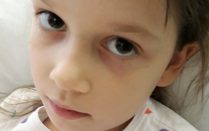 Zbiórka Alicja walczy z białaczką - zdjęcie główne